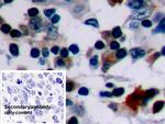 Bcl-2 Antibody in Immunohistochemistry (Paraffin) (IHC (P))