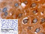 Bcl-2 Antibody in Immunohistochemistry (Paraffin) (IHC (P))