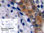 Bcl-2 Antibody in Immunohistochemistry (Paraffin) (IHC (P))