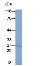 Bcl-2 Antibody in Western Blot (WB)