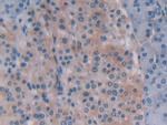Beclin 1 Polyclonal Antibody