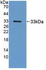 UPB1 Antibody in Western Blot (WB)