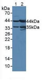 UPB1 Antibody in Western Blot (WB)