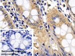 BID Antibody in Immunohistochemistry (Paraffin) (IHC (P))