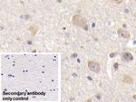 BID Antibody in Immunohistochemistry (Paraffin) (IHC (P))