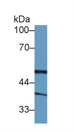Biliverdin Reductase Antibody in Western Blot (WB)