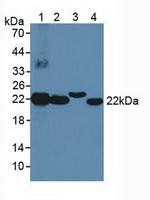 BLVRB Antibody in Western Blot (WB)