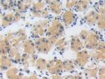 ZNF179 Polyclonal Antibody