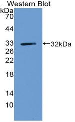 ZNF179 Antibody in Western Blot (WB)