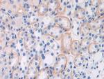 Brevican Antibody in Immunohistochemistry (Paraffin) (IHC (P))