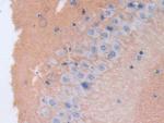 Brevican Antibody in Immunohistochemistry (Paraffin) (IHC (P))