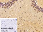 Brevican Antibody in Immunohistochemistry (Paraffin) (IHC (P))
