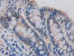 CDH16 Antibody in Immunohistochemistry (Paraffin) (IHC (P))