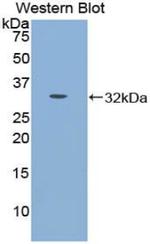 CDH16 Antibody in Western Blot (WB)