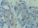 CAPS Antibody in Immunohistochemistry (Paraffin) (IHC (P))