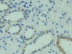 CAPS Antibody in Immunohistochemistry (Paraffin) (IHC (P))