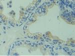CAPS Antibody in Immunohistochemistry (Paraffin) (IHC (P))