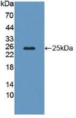 CAPS Antibody in Western Blot (WB)