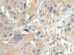 CALML3 Antibody in Immunohistochemistry (Paraffin) (IHC (P))
