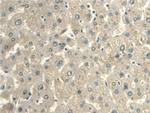 CALML3 Antibody in Immunohistochemistry (Paraffin) (IHC (P))