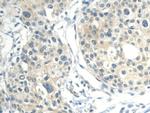 CALML3 Antibody in Immunohistochemistry (Paraffin) (IHC (P))