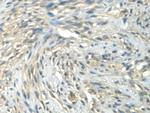 CALML3 Antibody in Immunohistochemistry (Paraffin) (IHC (P))