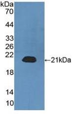 CALML3 Antibody in Western Blot (WB)