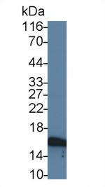 CALML3 Antibody in Western Blot (WB)