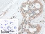 CALML5 Polyclonal Antibody