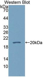 CALML5 Antibody in Western Blot (WB)