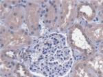 Calpain 9 Antibody in Immunohistochemistry (Paraffin) (IHC (P))