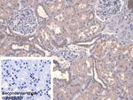 Calpain 9 Antibody in Immunohistochemistry (Paraffin) (IHC (P))