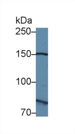 Calpain 9 Antibody in Western Blot (WB)