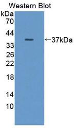 Calpain 9 Antibody in Western Blot (WB)