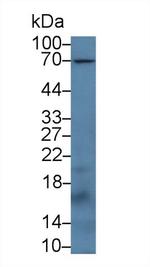 CD66e (CEA) Antibody in Western Blot (WB)