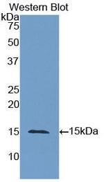 CD66e (CEA) Antibody in Western Blot (WB)