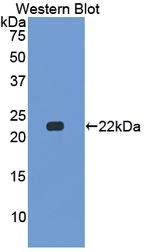 Beta-casein Antibody in Western Blot (WB)