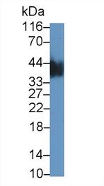 CSN3 (CASK) Antibody in Western Blot (WB)