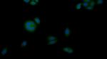 CK1 alpha Polyclonal Antibody