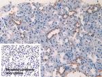 CK1 alpha Antibody in Immunohistochemistry (Paraffin) (IHC (P))