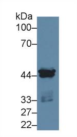 CK1 alpha Antibody in Western Blot (WB)