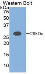 CK1 alpha Antibody in Western Blot (WB)