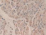 Caspase 3 Polyclonal Antibody