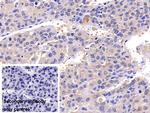 Caspase 8 Antibody in Immunohistochemistry (Paraffin) (IHC (P))