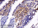 Caspase 8 Antibody in Immunohistochemistry (Paraffin) (IHC (P))
