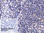 Caspase 8 Antibody in Immunohistochemistry (Paraffin) (IHC (P))