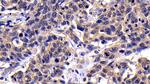 Caspase 8 Antibody in Immunohistochemistry (Paraffin) (IHC (P))