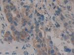 CARD9 Antibody in Immunohistochemistry (Paraffin) (IHC (P))