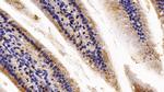 Catalase Antibody in Immunohistochemistry (Paraffin) (IHC (P))