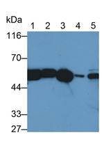 Catalase Antibody in Western Blot (WB)